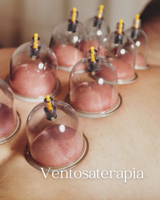 Ventosaterapia 