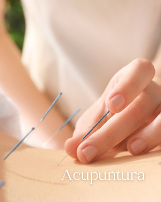Acupuntura